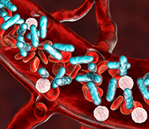 Grafik Sepsis